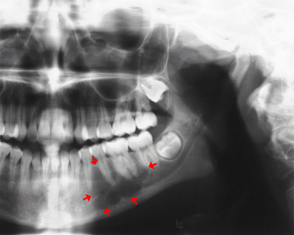image 1c
